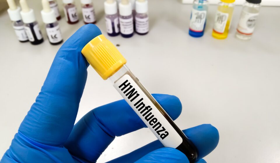 H1N1 está entre vírus furtados na Unicamp, diz site