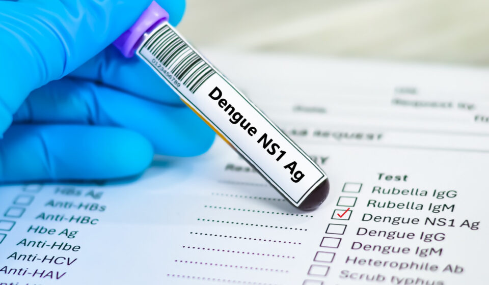 SUS agora tem teste rápido para dengue; veja como funciona