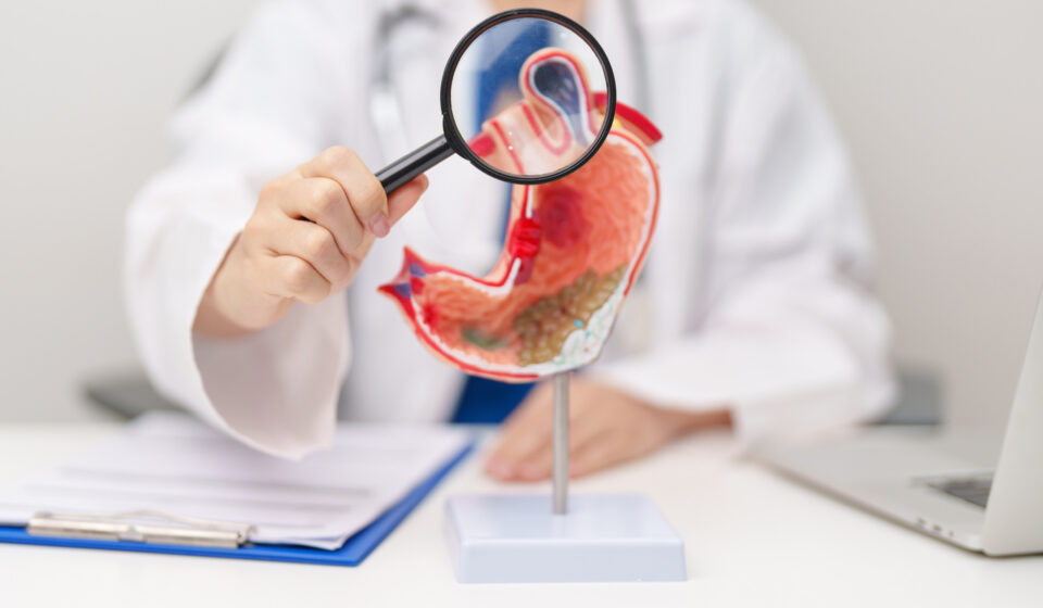 Suco gástrico descartado em endoscopias pode ajudar a detectar câncer de estômago
