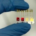Sensor brasileiro promete detectar câncer de pâncreas em minutos