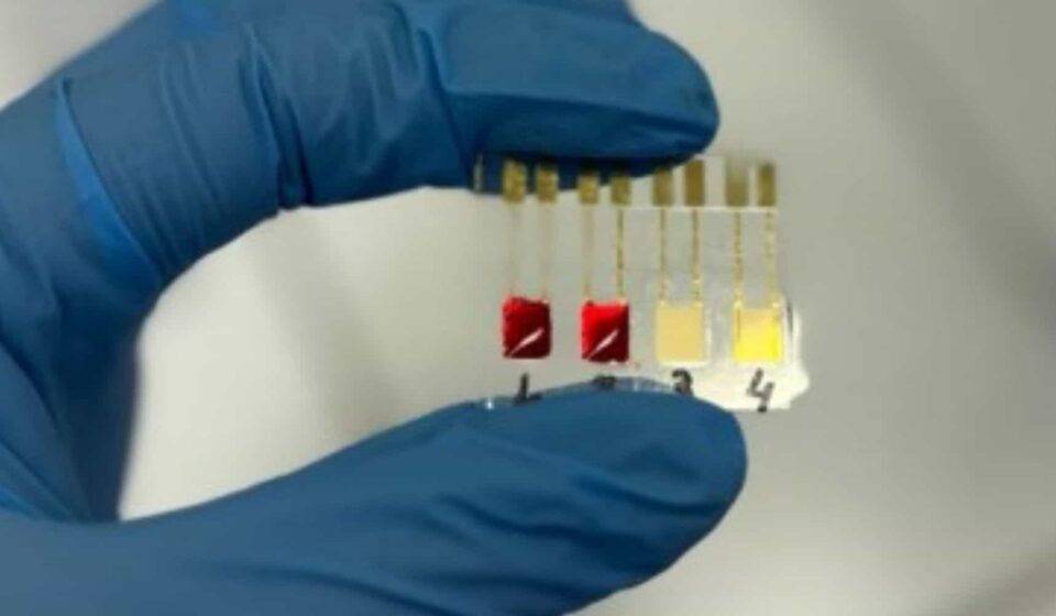 Sensor brasileiro promete detectar câncer de pâncreas em minutos